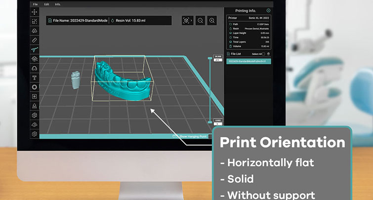 Пошаговое-руководство-по-3D-печати-моделей-коронок-и-мостов-с-помощью-съемных-матриц-10.jpg