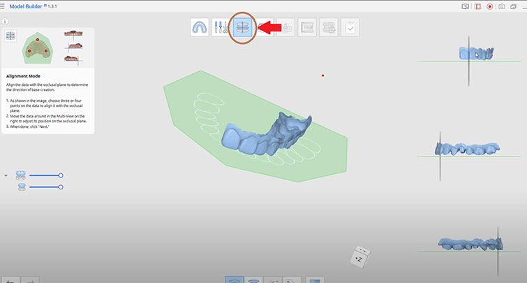 Пошаговое-руководство-по-3D-печати-моделей-коронок-и-мостов-с-помощью-съемных-матриц-8.jpg